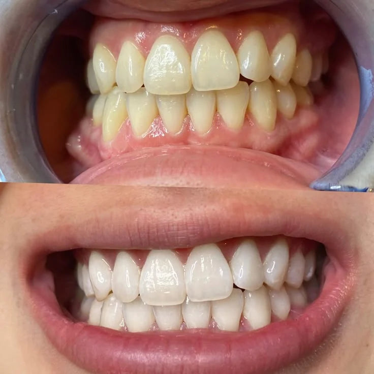 COMPLETE WHITENING PACK +
